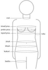 Postoperativni visoki abdominalni steznik OMC